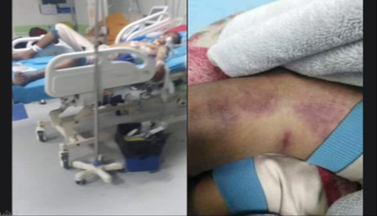 وفاة طفل بلدغة ثعبان وسط انعدام الامصال في محافظة إب