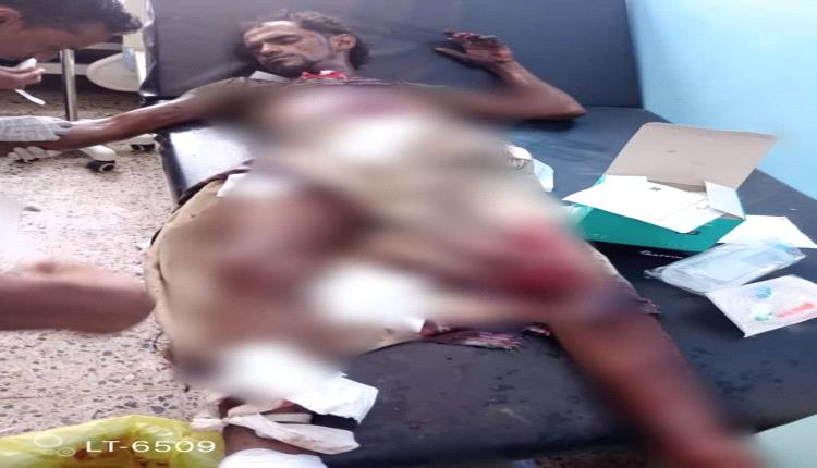 مقذوف حوثي ينفجر بعامل خردوات في حيس