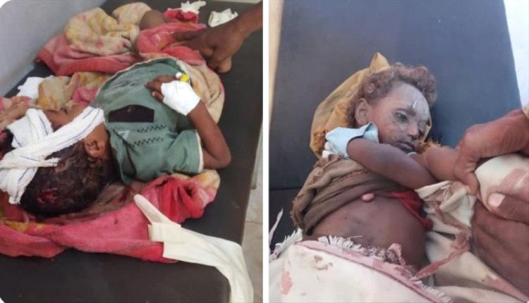 الحوثيون يرتكبون جريمة بشعة جديدة في تعز.. مقتل وإصابة 4 أطفال بقصف منزل في مقبنة
