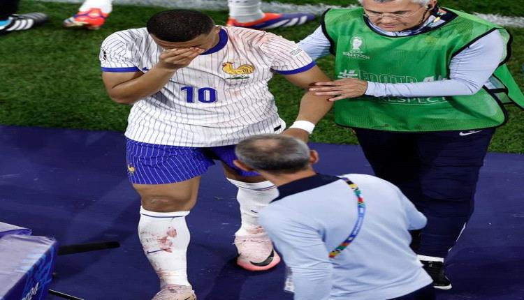 رئيس الاتحاد الفرنسي يكشف عن الحالة الصحية لمبابي