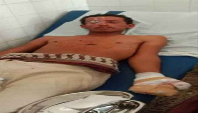 إصابة شاب بانفجار لغم حوثي في البيضاء بعد ساعات من حادثين مماثلين بتعز والحديدة