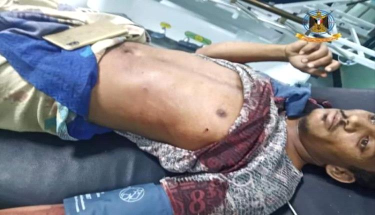 جريمة حوثية بشعة في الضالع.. الجماعة تقتل طفل وتصيب والده بقذائف الهاون