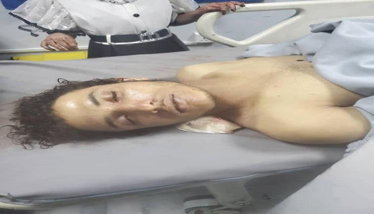 هزت صنعاء: قيادي حوثي يقتل شاب ويعتدي على أبويه طعنا بعد 30 عام من الوفاء والحراسة المجانية