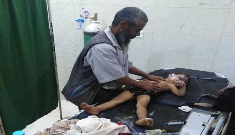 إصابة 4 أطفال نازحين بحريق في مخيم الفضي بمأرب