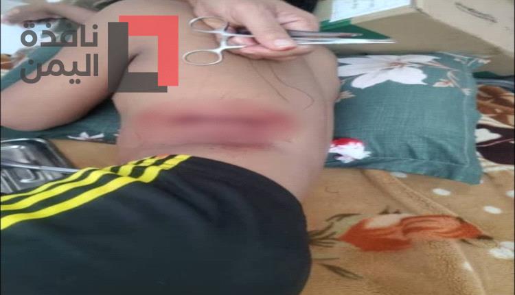 طعن شاب بوحشية بشبوة على يد 4 إثيوبيين.. ومطالب بترحيل قنابل موقوتة قبل فوات الأوان