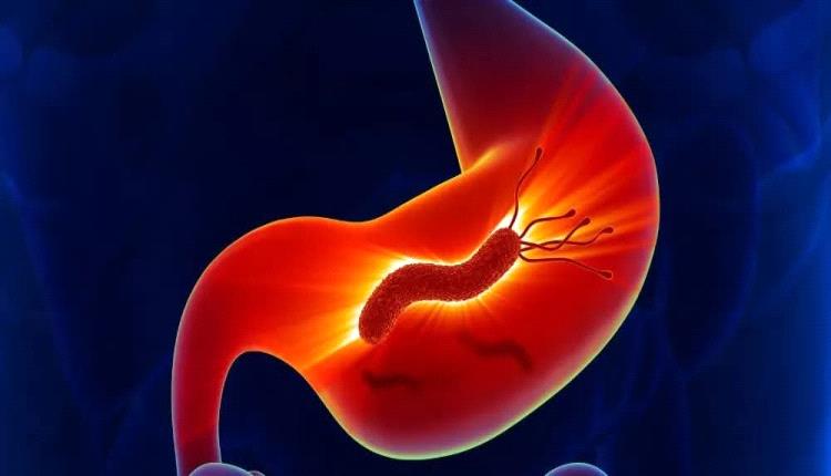 علاجات طبيعيه لحموضة المعدة.. تعرف عليها