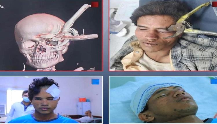 معجزة طبية: إنقاذ شاب اخترق جسم معدني جمجمته واستقر قرب الدماغ والعين بهذه المحافظة