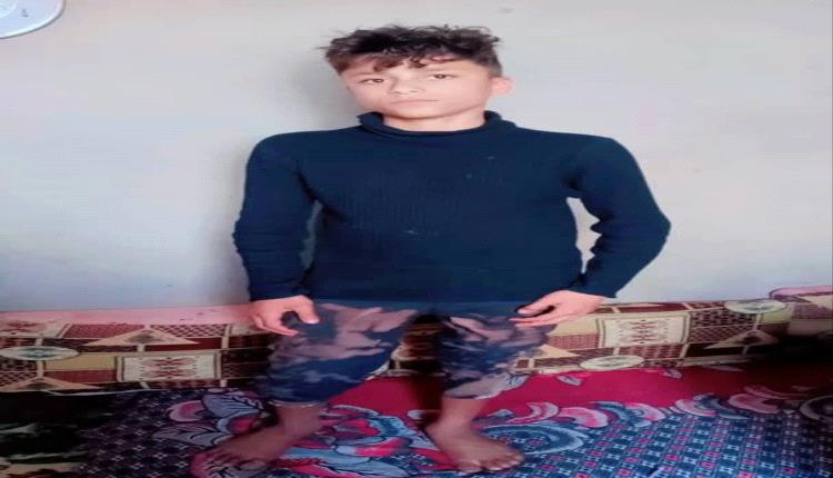 بعد 14 عامًا من الغياب.. طفل شرعبي يبحث عن أبيه المفقود