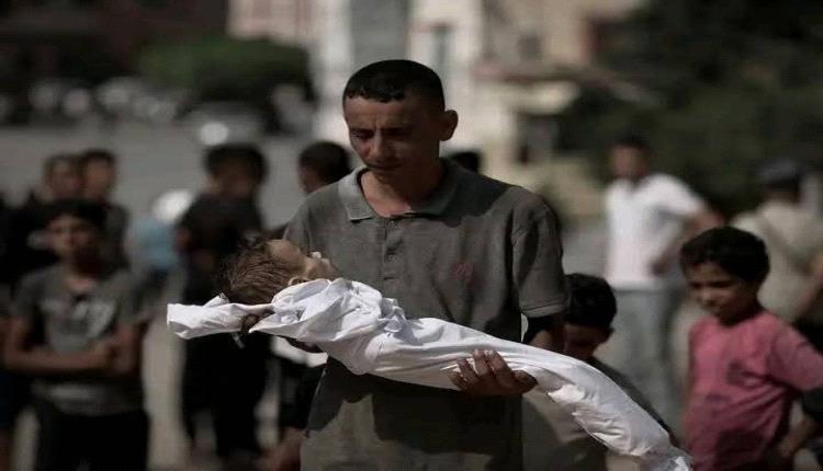 تسجيل حالات جديدة ضحايا التجويع في غزة.. ومقتل 12 بقصف إسرائيلي
