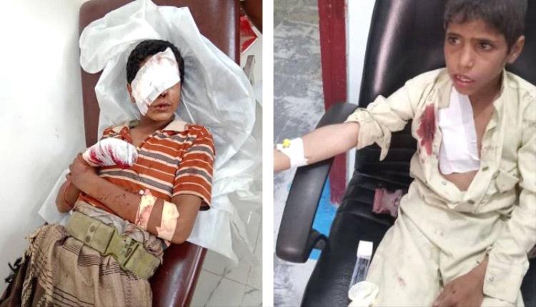 بعد 24 من مقتل فتاتين بلغم حوثي.. انفجار آخر يستهدف طفلين من أسرة واحدة بالجوف
