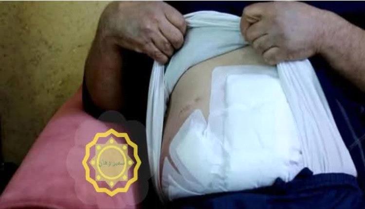 فوضى عائلية تتحول لجريمة دموية في صنعاء: شقيق يطعن أخاه بعد رؤيته ابنته تركب تاكسي بدون محرم
