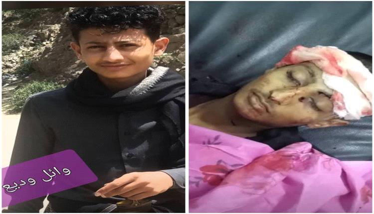 شقيق قائد محور الإخوان يقتل مرافقه الشخصي بدم بارد في لحظة جنون أمام الكريمي