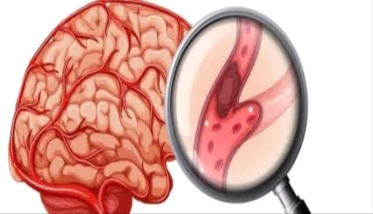 لقاح شائع يوفر حماية إضافية من السكتات الدماغية والجلطات