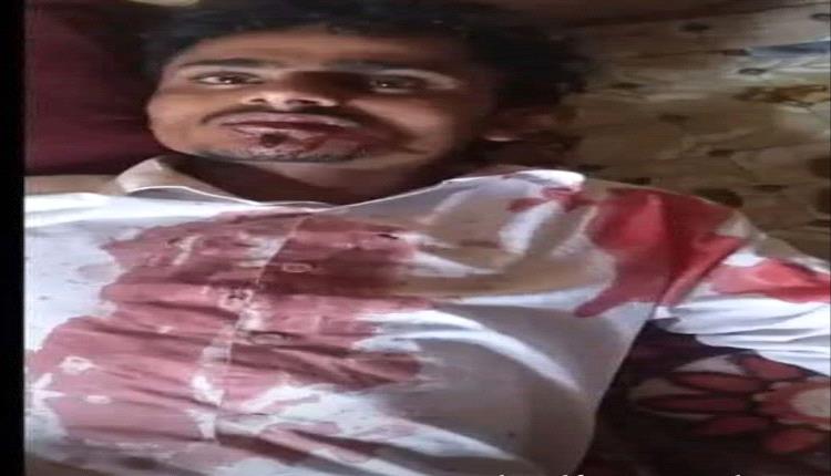 فرد أمن يعتدي بوحشية على شاب أصم وأبكم داخل مركز شرطة الاقروض بتعز