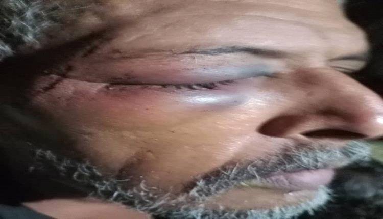 صور اعتداء وحشي.. مرافق مسؤول إخواني وشقيقه ينهالان بالضرب المبرح على ستيني في تعز
