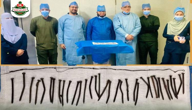 بدون تدخل جراحي.. فريق طبي مصري ينقذ سيدة ابتلعت 34 مسمارا