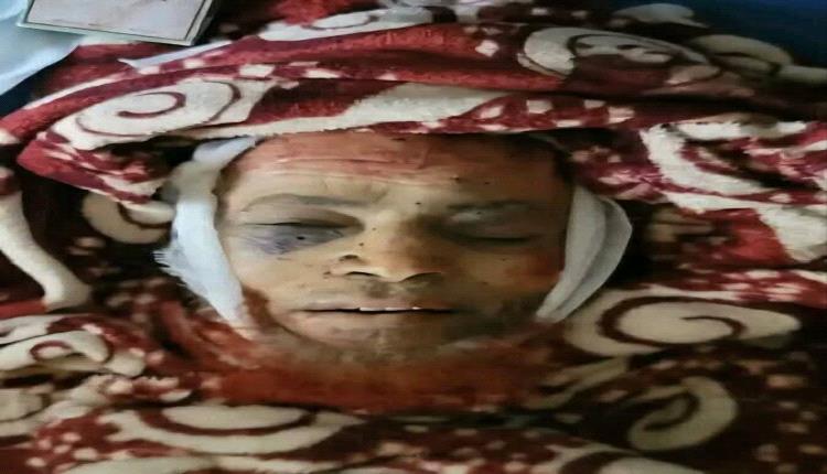اغتالوه وقصفوا بيته ويرفضون تسليم جثمانه.. تفاصيل جريمة الحوثي البشعة بحق شيخ القرآن