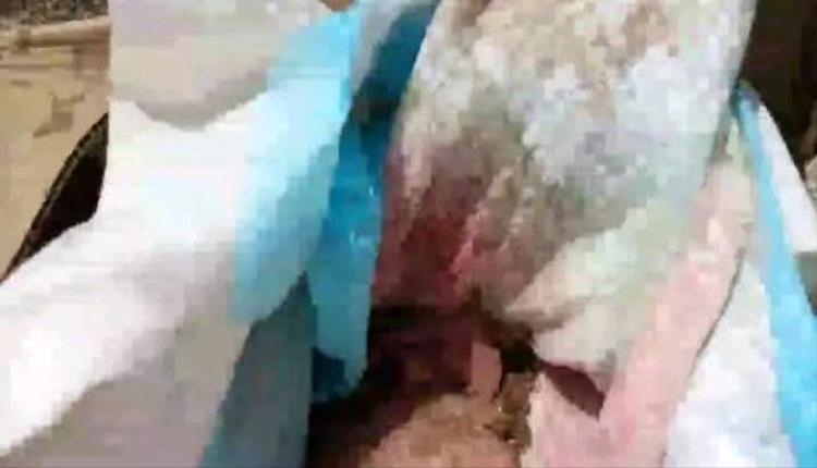تقشعر لها الأبدان: ذبحوا رضيعة ودفنوها في كرتون خلف مستشفى بالضالع وكشفتهم امرأة مسنة