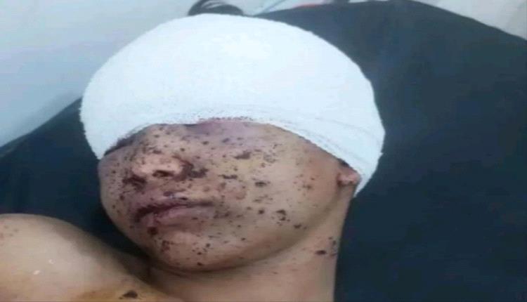 طفل يفقد إحدى عينيه بشظايا قذيفة هاون أطلقها الحوثي على حي سكني في تعز