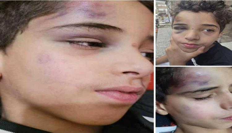 ضياء.. الطفل الذي كافأوه بالركل والصفع في صنعاء