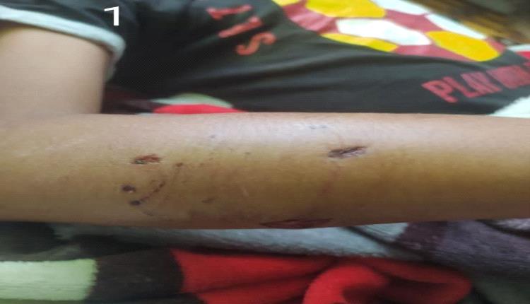 كلب مسعور يعقر طالبًا في تعز.. ونداءات غاضبة: أطفالنا ليسوا فريسة للضياع الرسمي