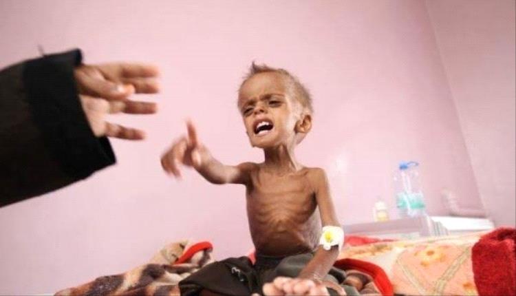 شهادة أممية.. اليمن ثالث أسوأ أزمة أمن غذائي في العالم بعد غزة والسودان