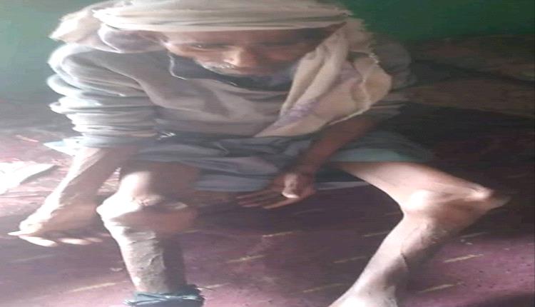 صور تصرخ بالموت.. مجاعة "حجور" ومشردو "الحديدة" يكشفون فصول الإبادة الحوثية الصامتة