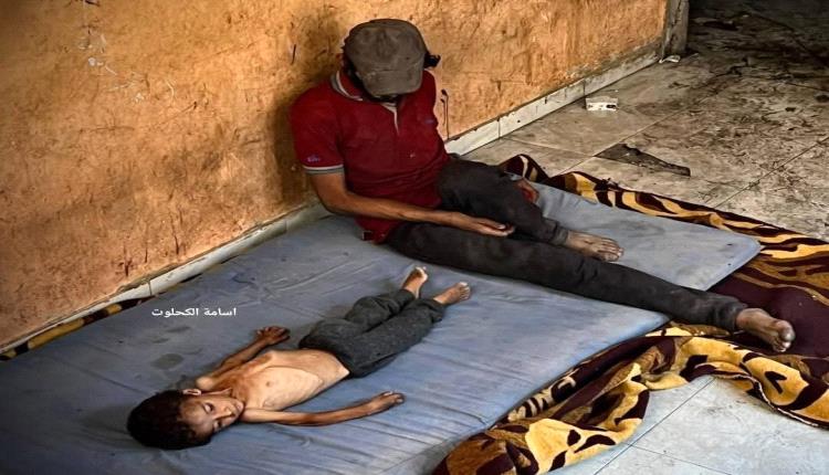 تسجيل 9 وفيات جديدة بسبب المجاعة في غزة خلال 24 ساعة