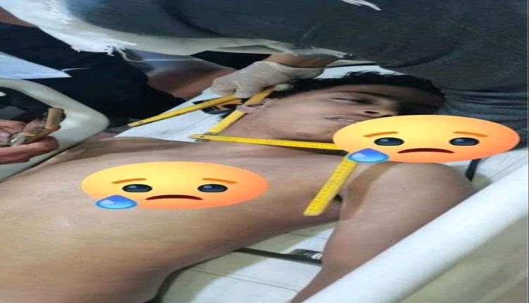مشعوذ يقتل شابًا في إب بـ"علاج قرآني".. داسته قدمه حتى لفظ أنفاسه