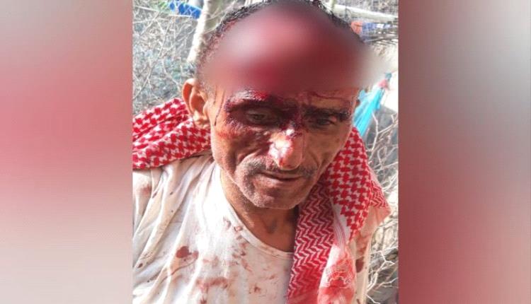 الحوثيون يعتدون بوحشية على طبيب أمام أسرته في إب