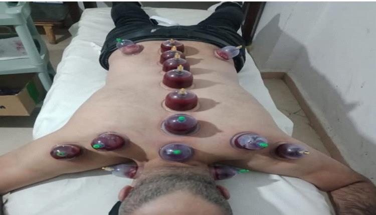 تعرف على فوائد العلاج بالحجامة