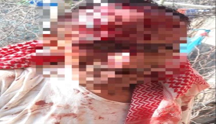 وحشية حوثية تهز إب.. اعتداء مروّع على طبيب أمام أسرته