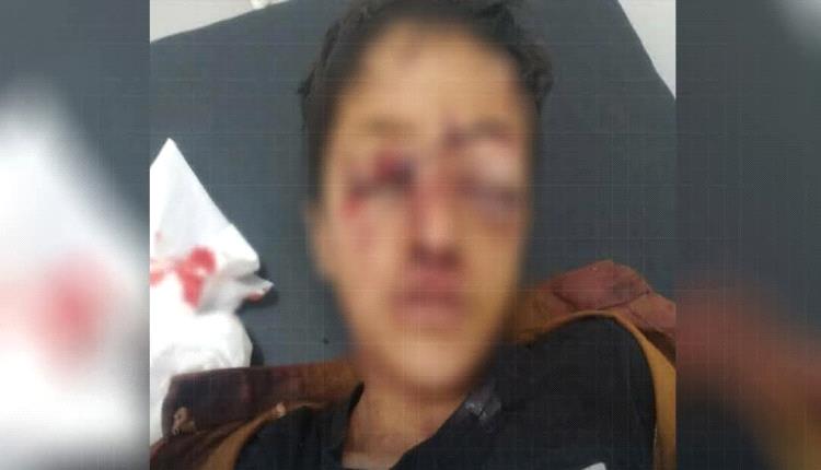 الشرعية تكشف جريمة حوثية جديدة في اليمن وتفضح زيف شعارات نصرة غزة
