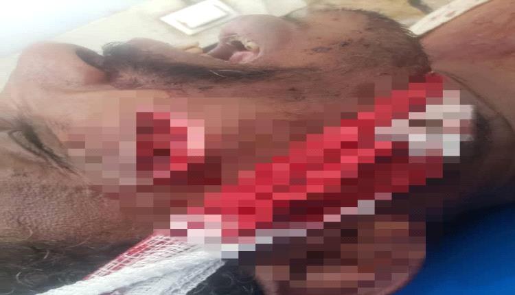 الموت القادم من السحول.. الحوثيون يجتاحون وادي عنة: قتل وتهجير ونهب بمباركة نيابية مشبوهة