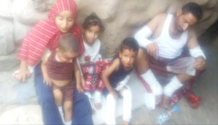 إب.. ‫كارثة تصيب أسرة بسبب أسطوانة غاز 