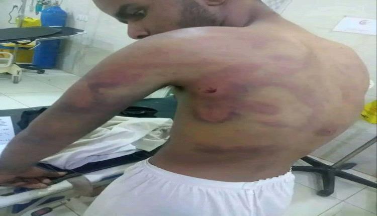 شاهد دهس واختطاف وتعذيب.. وادي عبيدة يهتز على وقع جريمة بشعة وسط صمت سلطات مأرب