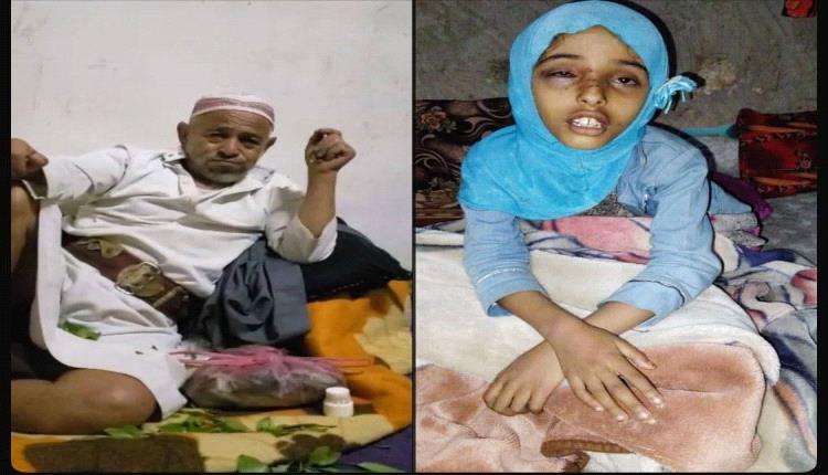 مسن عدواني يعتدي بوحشية على "رغد" ويُشوّه طفولتها أمام والدتها.. والأسرة تتعرض للتهديد