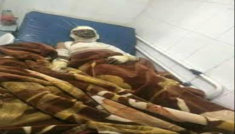 صرخة بالنار في وجه الجوع.. مواطن يشعل جسده في الحديدة احتجاجاً على جحيم الحوثي
