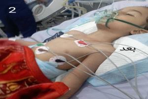 كارثة طبية تهز تعز.. جرعة مخدر تدخل الطفل 