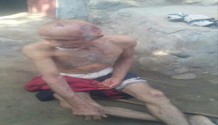 اعتداء وحشي من قبل مسلحين حوثيين على مسن في جبل رأس