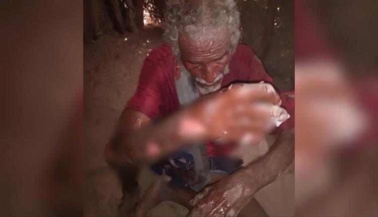 براءة تُفحَّم حيّة.. حريق يلتهم طفلة ويصيب أسرتها بهذه المحافظة