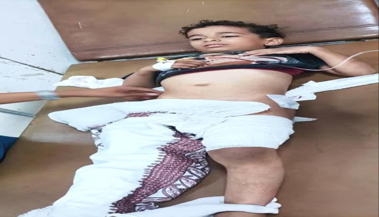 إصابة طفل برصاص قناص حوثي في مدينة تعز