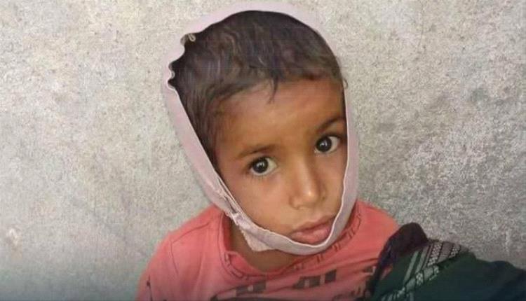 بدم بارد.. جماعة الحوثي تغتال طفولة وجدي في تعز بقصف مدفعي عشوائي