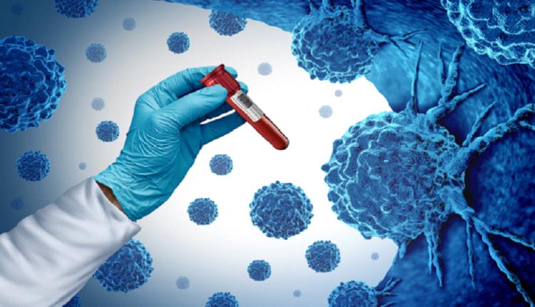 علماء روس يبتكرون تقنية جديدة تضاعف فعالية
أدوية سرطان الدم 8 مرات