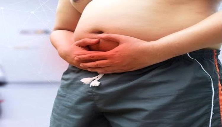 خطر خفي يتسلل إلى جهازك الهضمي.. السمنة تزيد خطر الإصابة بسرطان المعدة