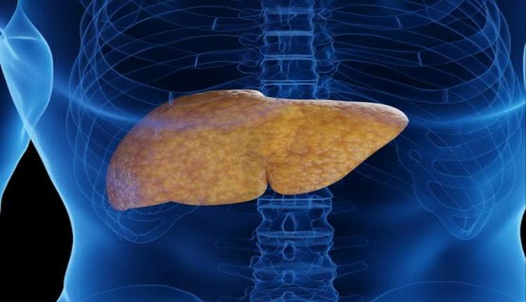 أطعمة ومشروبات تساعد في علاج الكبد الدهني