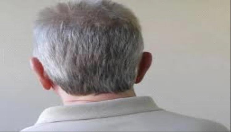 عادة صحية سيئة قد تسبب تساقط الشعر والشيب المبكر.. ما علاقة التدخين