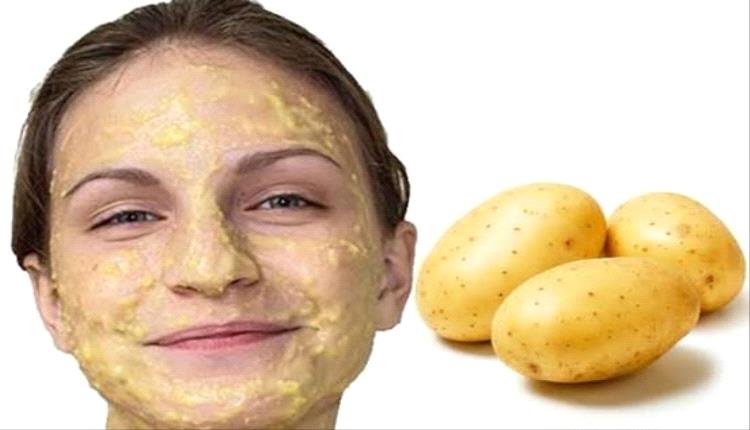 البطاطا.. كنز حقيقي للعناية بالبشرة