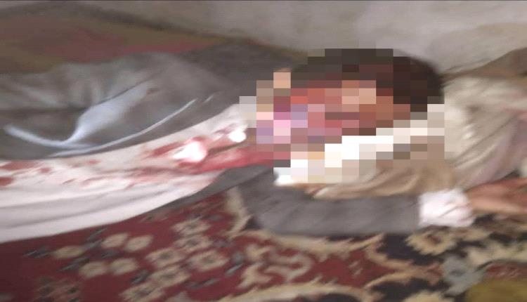 مقتل 2 ونقل آخرين للعناية المركزة في صنعاء.. أولاد عم يتقاتلون بالفؤوس