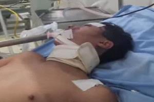 فاجعة جديدة تهز جامعة تعز.. وفاة الطالب الثالث في حادث الهندسة المميت بعد أيام من الصراع مع الموت